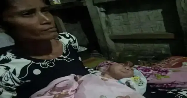 Bayi Lahir Tanpa Tempurung Kepala di Pandeglang Bayi Lahir Tanpa Tempurung Kepala di Pandeglang