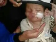 Terlahir Cacat di Bagian Wajah, Bayi Laura Butuh Pertolongan