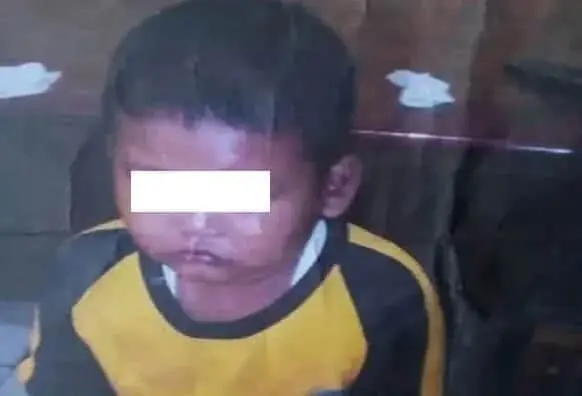 Bocah SD Tewas Disiksa Orangtuanya di Ciledug Bocah SD Tewas Disiksa Orangtuanya di Ciledug
