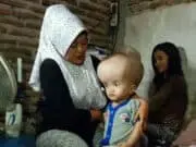 Butuh Uluran Tangan, Anak Tukang Gorengan di Serang Menderita Hydrocephalus Butuh Uluran Tangan, Anak Tukang Gorengan di Serang Menderita Hydrocephalus