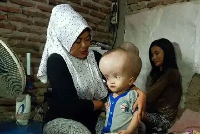 Butuh Uluran Tangan, Anak Tukang Gorengan di Serang Menderita Hydrocephalus Butuh Uluran Tangan, Anak Tukang Gorengan di Serang Menderita Hydrocephalus