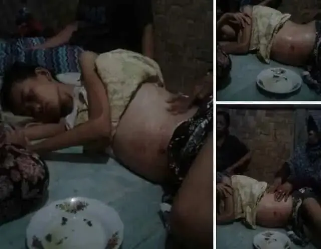 Tidak Punya Uang, Halimah Penderita Tumor Urungkan Berobat ke Rumah Sakit Tidak Punya Uang, Halimah Penderita Tumor Urungkan Berobat ke Rumah Sakit