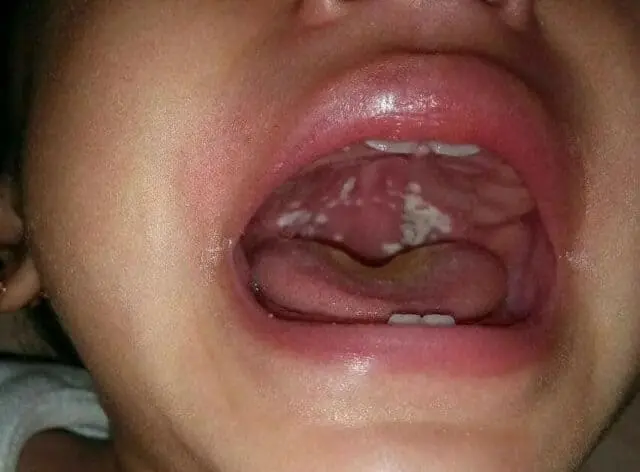 RSUD Banten Siapkan Dua Ruangan untuk Pasien Penderita Difteri RSUD Banten Siapkan Dua Ruangan untuk Pasien Penderita Difteri