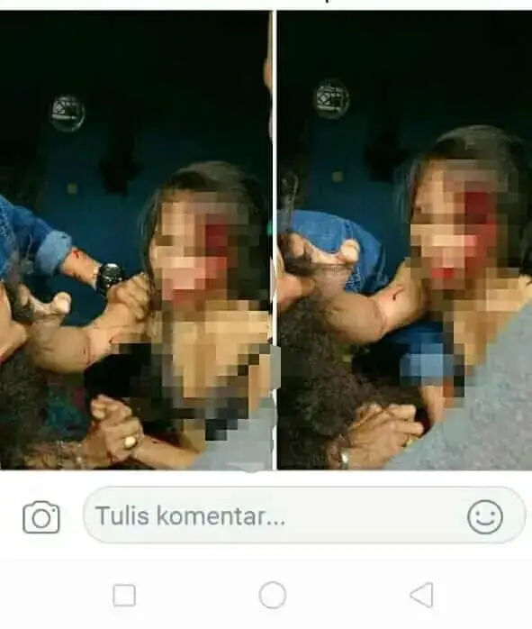 Suami Dibantu Teman Pukuli Istri Hingga Babak Belur