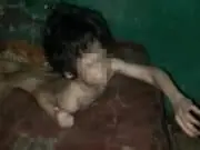 Dinsos Tangsel Evakuasi Bocah Dipasung Selama 3 Tahun Dinsos Tangsel Evakuasi Bocah Dipasung Selama 3 Tahun