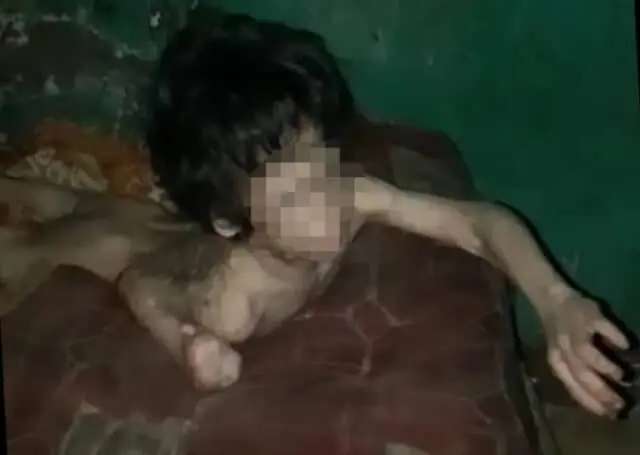 Dinsos Tangsel Evakuasi Bocah Dipasung Selama 3 Tahun Dinsos Tangsel Evakuasi Bocah Dipasung Selama 3 Tahun