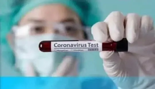Pemkot Serang Didesak Lakukan Rapid Tes Untuk Deteksi Sebaran Corona