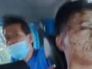 Seram! Remaja Asal Cipondoh Tangerang Jadi Korban Penyiraman Air Keras Seram! Remaja Asal Cipondoh Tangerang Jadi Korban Penyiraman Air Keras