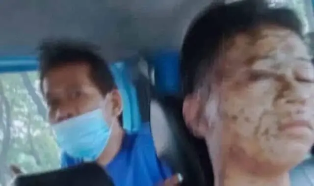 Seram! Remaja Asal Cipondoh Tangerang Jadi Korban Penyiraman Air Keras Seram! Remaja Asal Cipondoh Tangerang Jadi Korban Penyiraman Air Keras