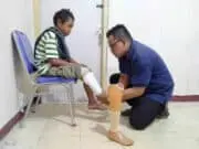 Rumah Yatim Berikan Kaki Palsu Untuk Capil Kaki Palsu Untuk Capil