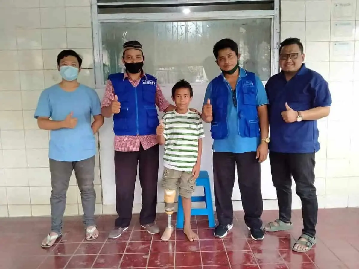 Kaki Palsu Untuk Capil