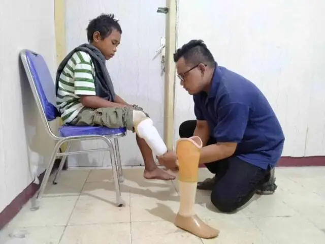 Kaki Palsu Untuk Capil Kaki Palsu Untuk Capil