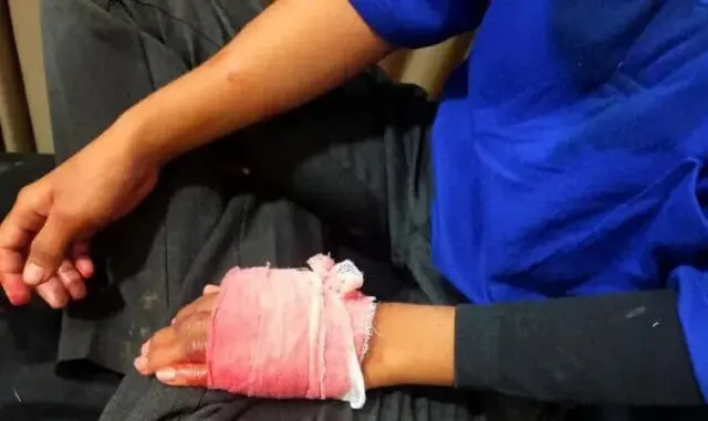 Begal Beraksi di Tangerang, Mamah Muda Bonceng 2 Anak Dibacok Pelaku di Door