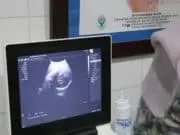 Puskemas di Kota Tangerang Beri Layanan USG Gratis, Salah Satunya Ada di Cipondoh Puskemas di Kota Tangerang Beri Layanan USG Gratis, Salah Satunya Ada di Cipondoh