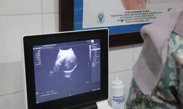 Puskemas di Kota Tangerang Beri Layanan USG Gratis, Salah Satunya Ada di Cipondoh Puskemas di Kota Tangerang Beri Layanan USG Gratis, Salah Satunya Ada di Cipondoh