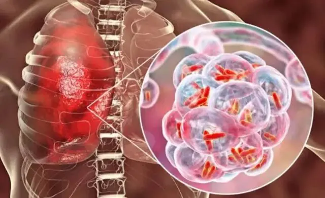 Kasus Pneumonia Merebak di Cina, Masyarakat Diimbau Terapkan PHBS Kasus Pneumonia Merebak di Cina, Masyarakat Diimbau Terapkan PHBS