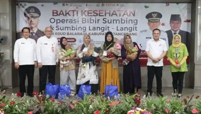 Bakti Kesehatan Gratis, RSUD Balaraja Gelar Operasi Bibir Sumbing Bakti Kesehatan Gratis, RSUD Balaraja Gelar Operasi Bibir Sumbing